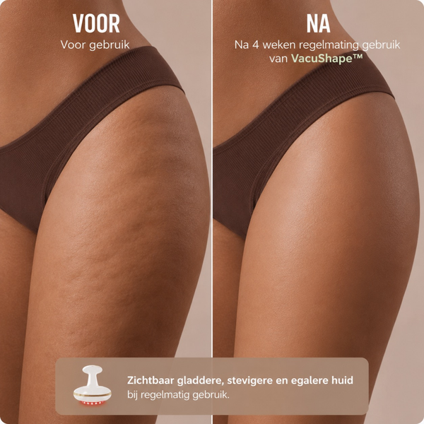 Anti-cellulite Verwarmde Massager